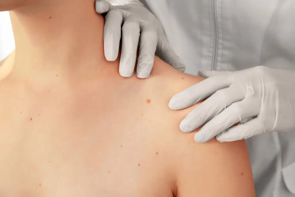 Dermatology books